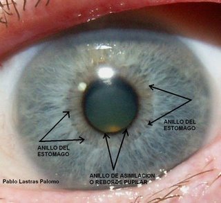 Iridologia. Anillo del estómago